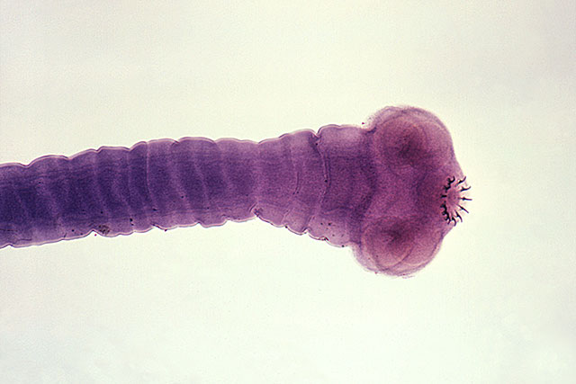 cysticercosis_001