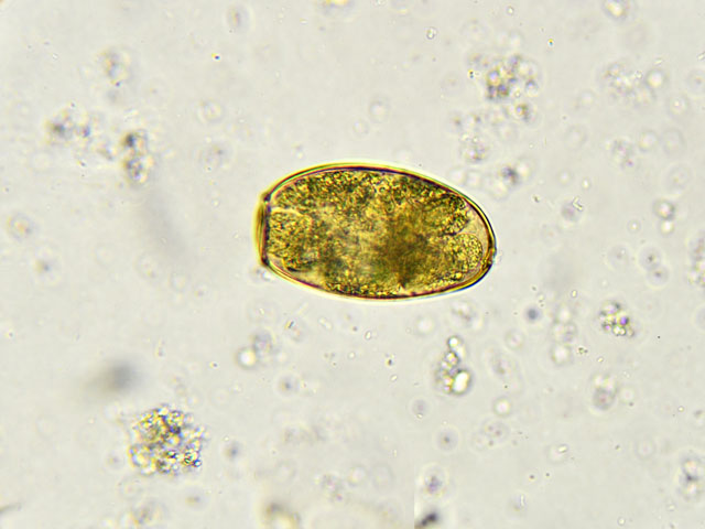 Foodborne trematode infections
