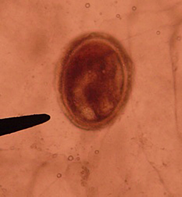 Foodborne trematode infections