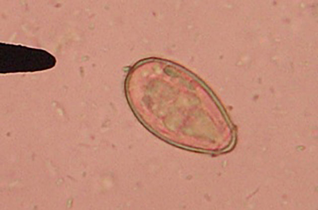 Foodborne trematode infections