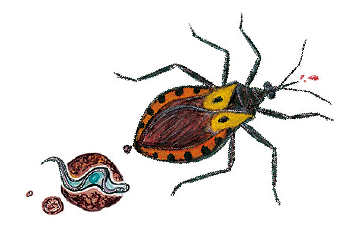 Chagas disease
