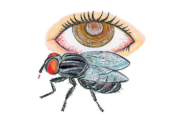 Trachoma
