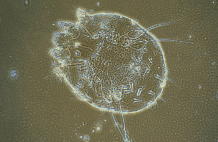 scabies_003