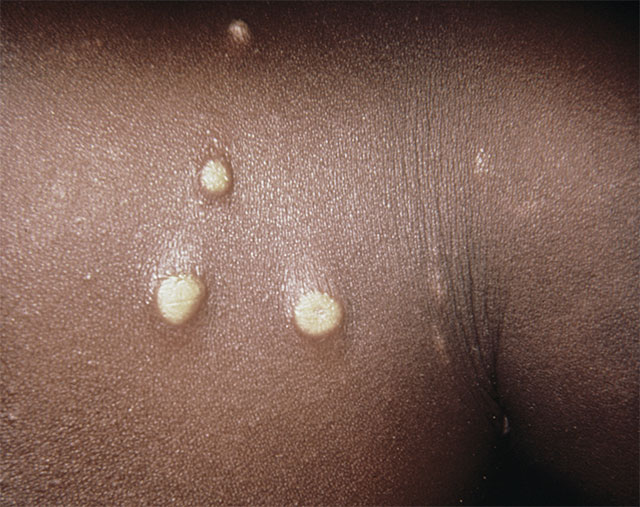yaws_002